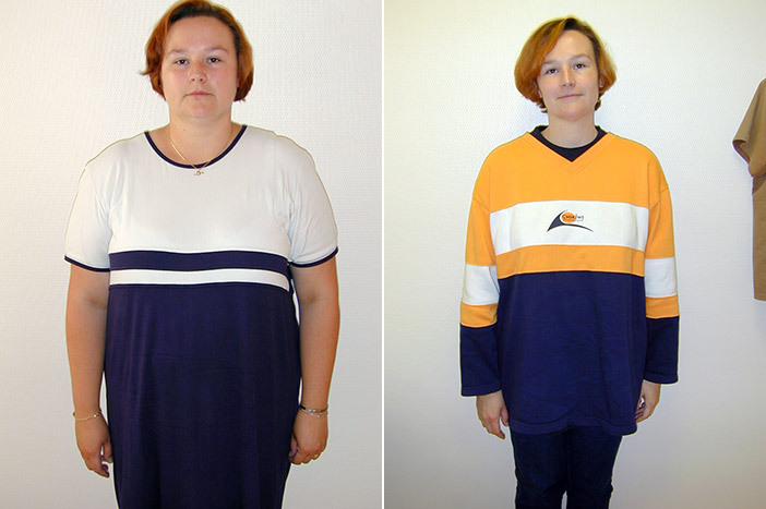 Sleeve gastrique Tunisie : prix sleeve gastrectomie tunisie Sleeve gastrique Tunisie : prix sleeve gastrectomie tunisie