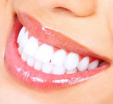 dents blanches hollywood smile