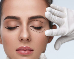 Blepharoplastie laser Tunisie